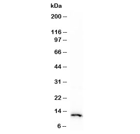Western blot testing of human HeLa cell lysate with recombinant S100A4 antibody (clone PS1A4-1R). Predicted molecular weight ~12 kDa.~