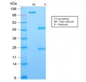 SDS-PAGE analysis of purified, BSA-free recombinant Bcl6 antibody (clone rBCL6/1718) as confirmation of integrity and purity.