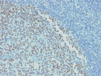 IHC testing of FFPE human tonsil with recombinant Bcl6 antibody (clone rBCL6/1718). Required HIER: boil tissue sections in 10mM citrate buffer, pH 6, for 10-20 min.~