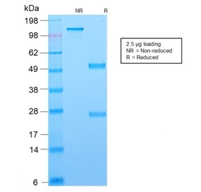 SDS-PAGE analysis of purified, BSA-free recombinant Bcl6 antibody (clon