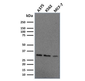 Western blot testing of human A375, K562 and MCF7 cell lysate with RPA32 antibody. Expected molecular weight ~32 kDa.~