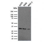 Western blot testing of human A375, K562 and MCF7 cell lysate with RPA32 antibody. Expected molecular weight ~32 kDa.