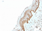 IHC staining of FFPE human skin with S100A2 antibody (clone CPTC-S100A2-2). HIER: boil tissue sections in pH6, 10mM citrate buffer, for 10-20 min and allow to cool before testing.