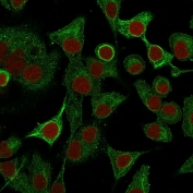 Immunofluorescent staining of human A549 cells with S100A2 antibody (green, clone CPTC-S100A2-2) and Reddot (nuclear stain).