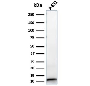 Western blot testing of human A431 lysate with S100A2 antibody. Expected molecular weight ~11 kDa.