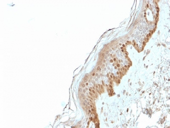 IHC staining of FFPE human skin with S100A2 antibody. HIER: boil tissue sections in pH6, 10mM citrate buffer, for 10-20 min and allow to cool before testing.~
