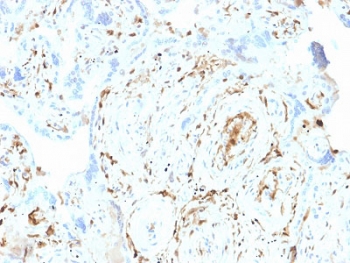 IHC staining of FFPE human placenta with S100A2 antibody. HIER: boil tissue se