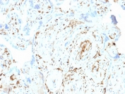 IHC staining of FFPE human placenta with S100A2 antibody (clone CPTC-S100A2-2). HIER: boil tissue sections in pH6, 10mM citrate buffer, for 10-20 min and allow to cool before testing.