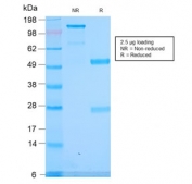 SDS-PAGE analysis of purified, BSA-free recombinant Spectrin alpha 1 antibody (clone SPTA1/2939R) as confirmation of integrity and purity.