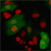 Immunofluorescent staining of permeabilized human A549 cells with recombinant S100A4 antibody (green, clone S100A4/2750R) and Reddot (red, nuclear stain).