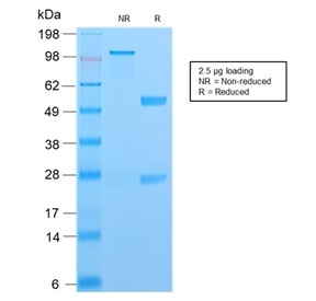 SDS-PAGE analysis of purified, BSA-free recombinant S100A4 antibody as confirmation of integrity and purity.