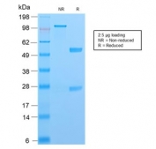 SDS-PAGE analysis of purified, BSA-free recombinant S100A4 antibody as confirmation of integrity and purity.