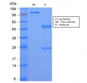 SDS-PAGE analysis of purified, BSA-free recombinant SAA antibody (clone SAA/2868R) as confirmation of integrity and purity.
