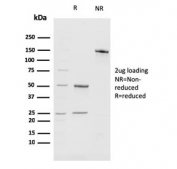 SDS-PAGE analysis of purified, BSA-free BMI1 antibody (clone BMI1/2689) as confirmation of integrity and purity.