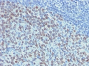 IHC testing of FFPE human tonsil with recombinant Bcl6 antibody (clone ARBC6-2R). Required HIER: boil tissue sections in 10mM citrate buffer, pH 6, for 10-20 min.