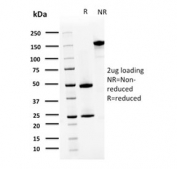 SDS-PAGE analysis of purified, BSA-free S100A4 antibody (clone CPTC-S100A4-3) as confirmation of integrity and purity.