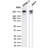 Western blot testing of human PANC-1 and HeLa cell lysate with recombinant Spectrin beta III antibody (clone SPTBN2/2894R). Predicted molecular weight ~246 kDa.