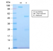SDS-PAGE analysis of purified, BSA-free recombinant Spectrin beta III antibody (clone SPTBN2/2894R) as confirmation of integrity and purity.