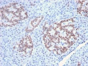 IHC staining of FFPE human pancreas with HNF1A antibody (clone HNF1A/2087). HIER: boil tissue sections in pH6, 10mM citrate buffer, for 10-20 min and allow to cool before testing.