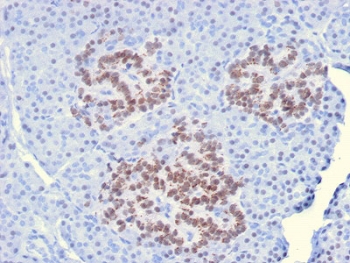IHC staining of FFPE human pancreas with HNF1A antibody. HIER: boil tissue sections in pH6, 10mM citrate buffer, for 10-20 min and allow to cool before testing.