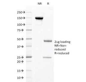 SDS-PAGE analysis of purified, BSA-free HNF1A antibody as confirmation of integrity and purity.