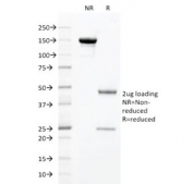 SDS-PAGE analysis of purified, BSA-free HNF1A antibody (clone HNF1A/2087) as confirmation of integrity and purity.
