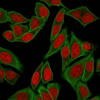 Immunofluorescent staining of fixed and permeabilized human HeLa cells with recombinant Spectrin beta III antibody (green, clone SPTBN2/2887R) and Reddot nuclear stain (red).~