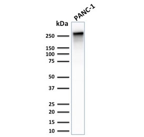 Western blot testing of human PANC-1 and HeLa cell lysate wit