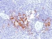 IHC testing of FFPE human spleen with TRAF1 antibody (clone TRAF1/2770). HIER: boil tissue sections in pH6, 10mM citrate buffer, for 10-20 min followed by cooling at RT for 20 min.