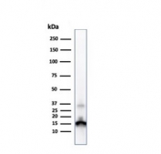 Western blot testing of human kidney lysate with Prealbumin antibody (clone CPTC-TTR-1). Predicted molecular weight ~16 kDa.