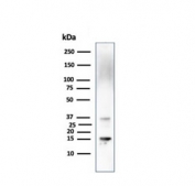 Western blot testing of human liver lysate with Prealbumin antibody (clone CPTC-TTR-1). Predicted molecular weight ~16 kDa.