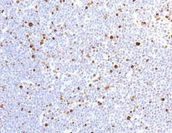 IHC testing of FFPE human lymph node with recombinant MCM7 antibody (clone MMCC7-1R). Required HIER: boil tissue sections in pH 9 10mM Tris with 1mM EDTA for 10-20 min.~