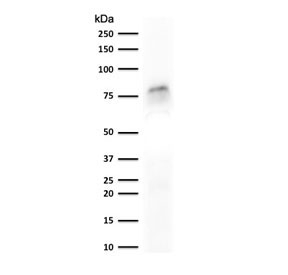 Western blot testing of human MCF7 cell lysate with recombinant MCM