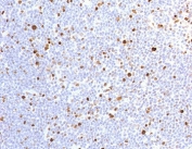 IHC testing of FFPE human lymph node with recombinant MCM7 antibody (clone MMCC7-1R). Required HIER: boil tissue sections in pH 9 10mM Tris with 1mM EDTA for 10-20 min.