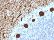 IHC testing of FFPE human cerebellum with CA8 antibody (clone CPTC-CA8-2). HIER: boil tissue sections in pH6, 10mM citrate buffer or pH 9 10mM Tris with 1mM EDTA for 10-20 min followed by cooling at RT for 20 min.