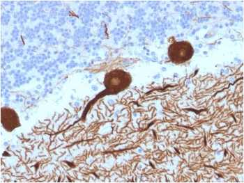 IHC testing of FFPE human cerebellum with CA8 antibody (clone CPTC-CA8-2). HIER: boil tissue sections in pH6, 10mM citrate buffer, for 10-20 min followed by cooling at RT for 20 min.~