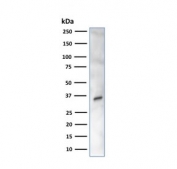 Western blot testing of human K562 cell lysate with CA8 antibody. 