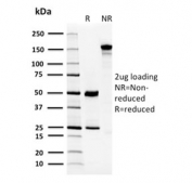 SDS-PAGE analysis of purified, BSA-free CA8 antibody (clone CPTC-CA8-2) as confirmation of integrity and purity.