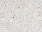 IHC testing of FFPE human cerebellum with Calretinin antibody (clone CALB2/2603). HIER: boil tissue sections in pH 9 10mM Tris with 1mM EDTA for 10-20 min followed by cooling at RT for 20 min.