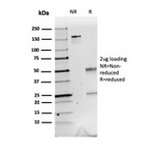 SDS-PAGE analysis of purified, BSA-free Calretinin antibody (clone CALB2/2603) as confirmation of integrity and purity.