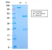 SDS-PAGE analysis of purified, BSA-free recombinant B7-H4 antibody (clone B7H4/2652R) as confirmation of integrity and purity.