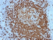 IHC testing of FFPE human lymph node with TCL1 antibody (clone TCL1/2079). HIER: boil tissue sections in pH 9 10mM Tris with 1mM EDTA for 10-20 min followed by cooling at RT for 20 min.