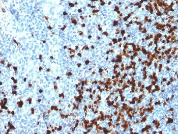IHC testing of FFPE human tonsil with TCL1 antibody. HIER: boil tiss