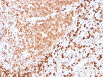 IHC testing of FFPE human tonsil with recombinant TCL1 antibody. HIER: boil tissue sections in pH 9 10mM Tris with 1mM EDTA for 10-20 min followed by cooling at RT for 20 min.~