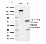 SDS-PAGE analysis of purified, BSA-free BAP1 antibody (clone BAP1/2432) as confirmation of integrity and purity.