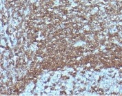 IHC staining of FFPE human tonsil tissue with recombinant CD6 antibody (clone CDLA6-2R). HIER: boil tissue sections in pH6, 10mM citrate buffer, for 10-20 min followed by cooling at RT for 20 min.