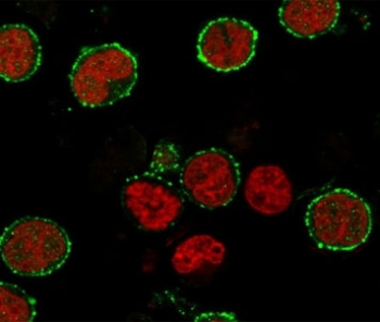 Immunofluorescent staining of human MOLT4 cells with CD6 antibody (clone CDLA6-2R, green) and Reddot nuclear stain (red).~
