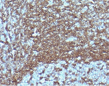 IHC staining of FFPE human tonsil tissue with recombinant CD6 antibody (clone CDLA6-2R). HIER: boil tissue section