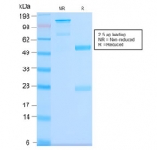 SDS-PAGE analysis of purified, BSA-free recombinant CD63 antibody (clone LAMP3/2990R) as confirmation of integrity and purity.