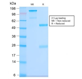 SDS-PAGE analysis of purified, BSA-free rec
